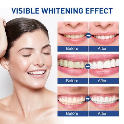 Teeth Whitening Pen 3ml